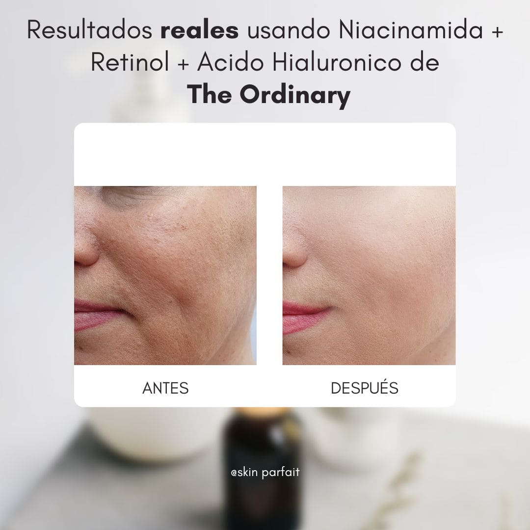 Edición Día de la Madre: Niacinamida + Retinol + Ácido Hialurónico The Ordinary